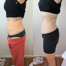 Load image into Gallery viewer, FAT REMOVAL - Pre Pay Packages
